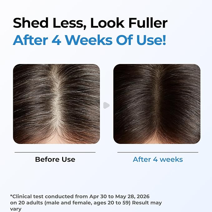 RootRevive™ Hair Growth Serum