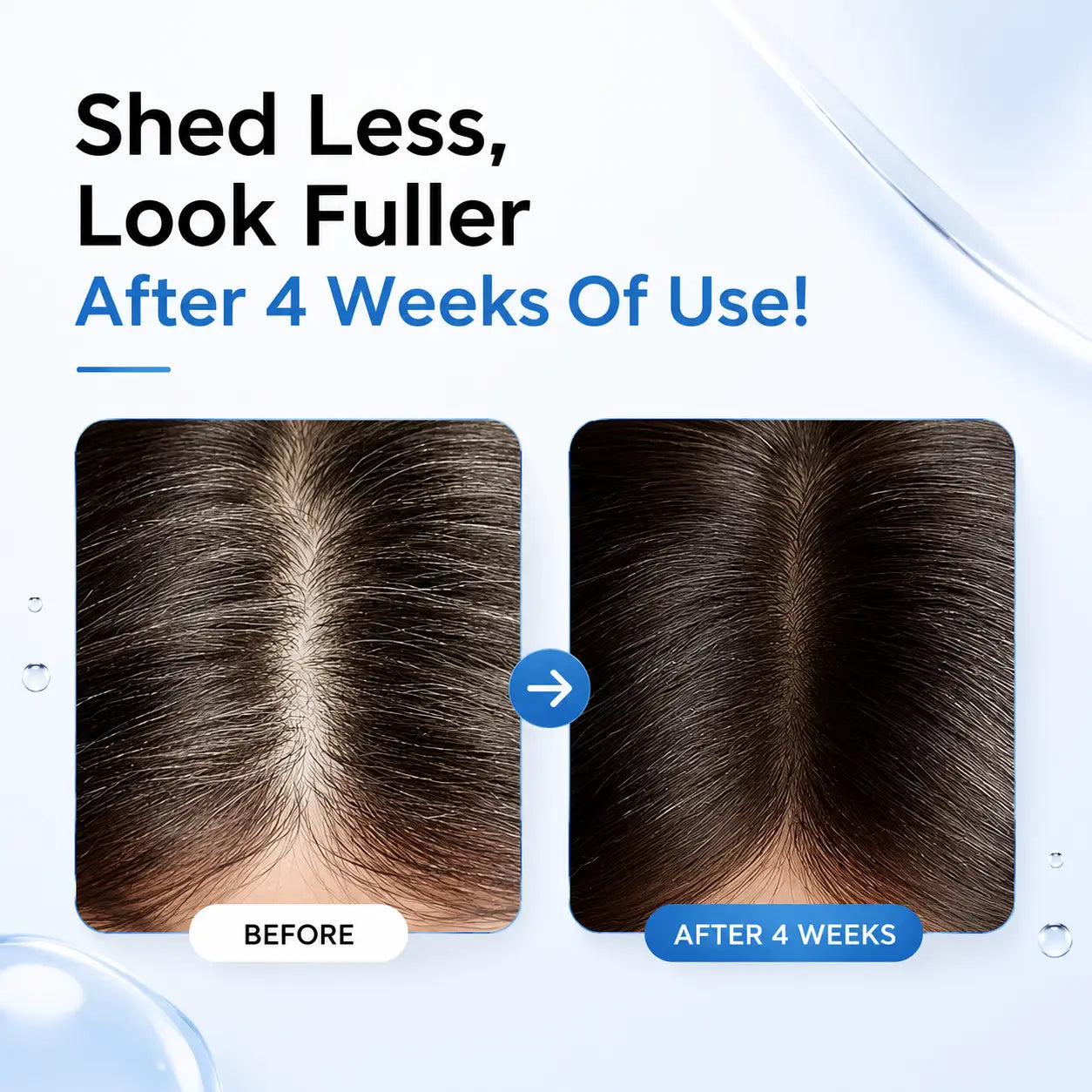 RootBiome™ Scalpy Hair Growth Serum