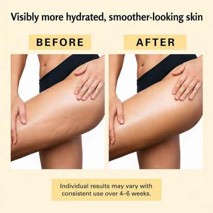 Silk™ Anti Cellulite Body Oil